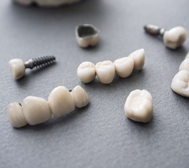 St. Louis The Difference Between Dental Implants and Mini Dental Implants