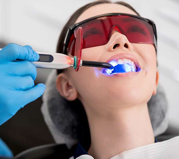 St. Louis Professional Teeth Whitening